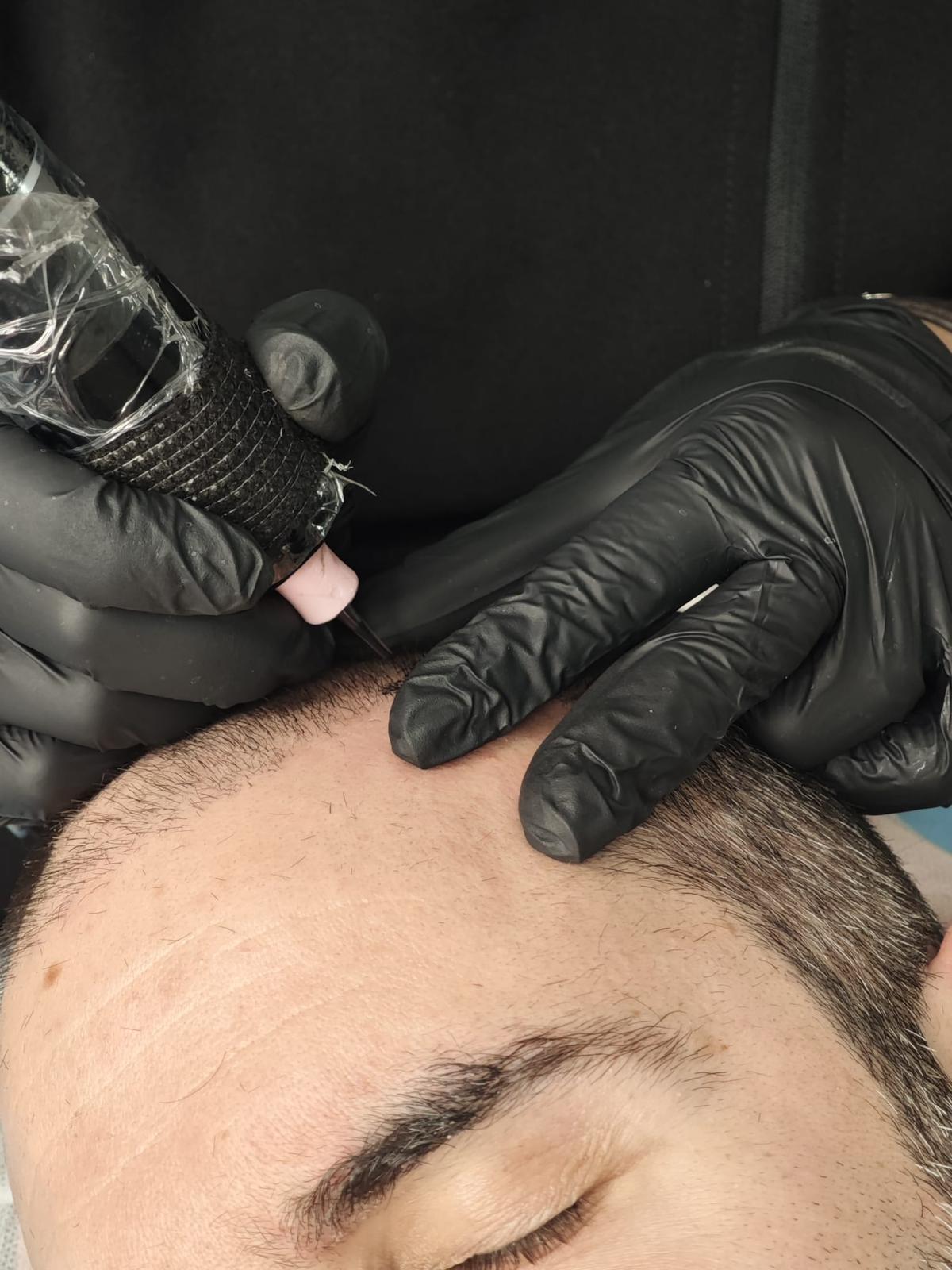 Micropigmentación capilar SMP